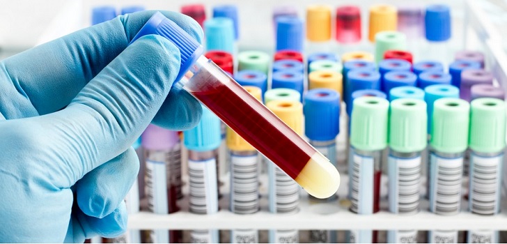 Análisis clínico en un laboratorio Laboratorios Echevarne crece en Andalucía con la absorción de Sevilab